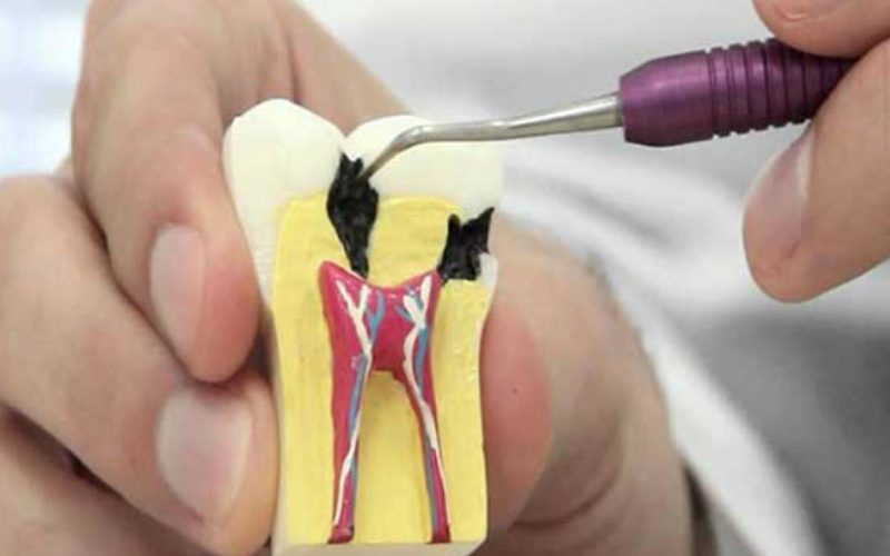 Endodonti